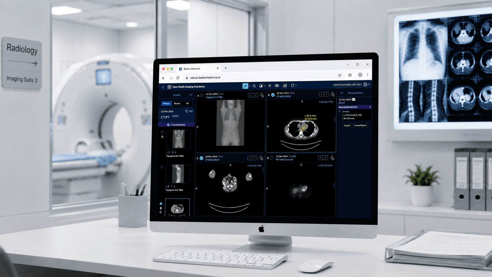 The Better Medicine imaging viewer showing CT scans, on a desk beside a scanner